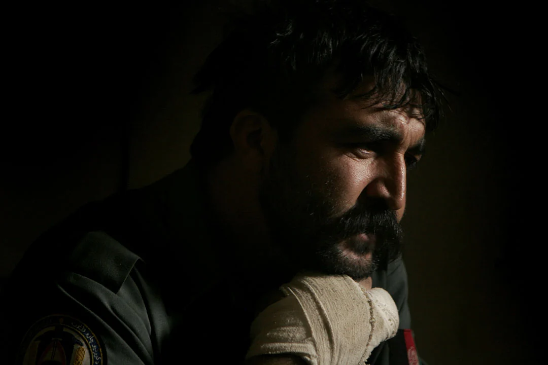 A police commander rests his chin on a bandaged hand, his face lit from the side.
